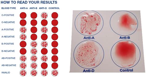 analyzer lab blood typing|materials needed for blood typing.